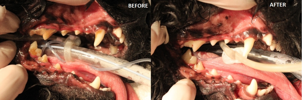 Dental Before and After