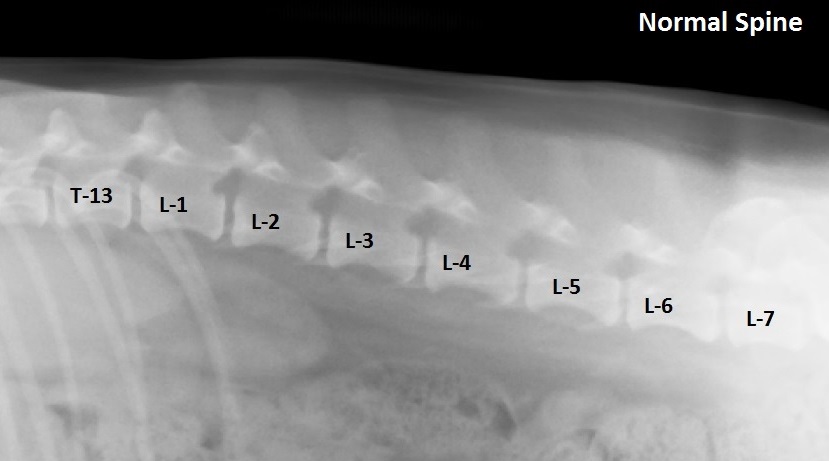 Normal Spine