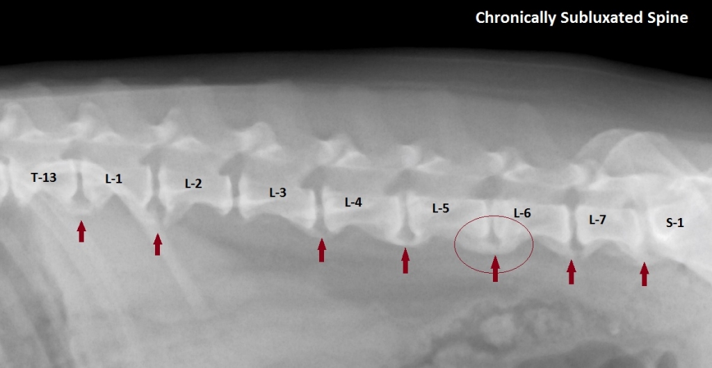 Chronically Subluxated Spine